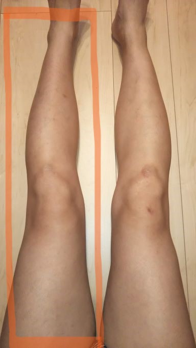 legs-hair-removal 5.jpg