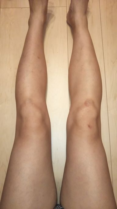 legs-hair-removal 3.jpg