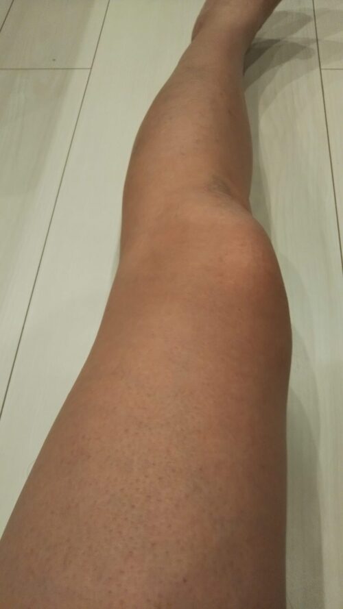 legs-hair-removal 1.jpg