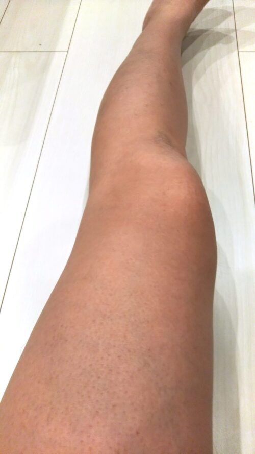 legs-hair-removal 2.jpg