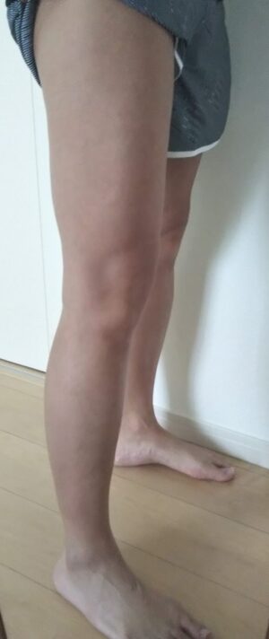 legs-hair-removal 7.jpg